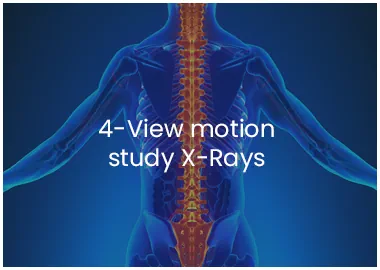 Chiropractic Xrays By The Best Chiropractors In Austin Texas