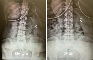 Chiropractic Adjustment Austin | Espinoza Chiropractic | Chiropractor In Austin Tx | Chiropractor Austin Tx Chiropractic Adjustment Austin | Espinoza Chiropractic | Chiropractor In Austin Tx | Chiropractor Austin Tx